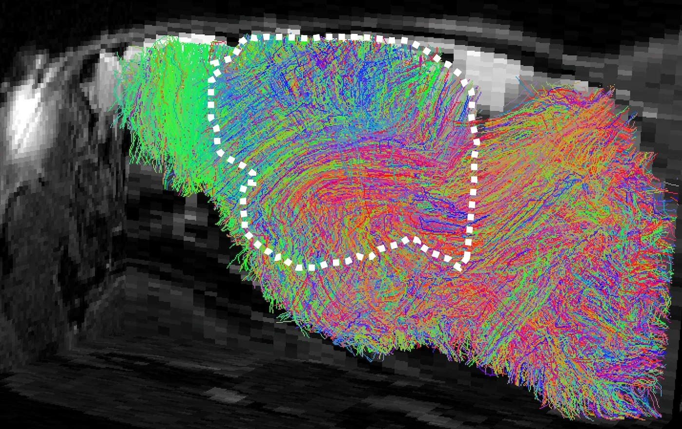 Stanford: човешки неврони в мишки разкриват болести